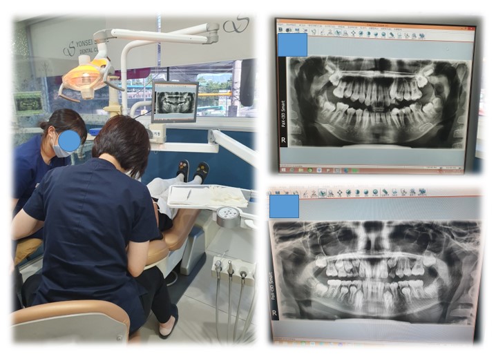 2023 아동치과치료.jpg